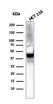KRT8 Antibody