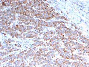 KRT18 Antibody