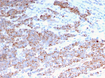 KRT18 Antibody
