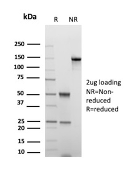 KRT18 Antibody