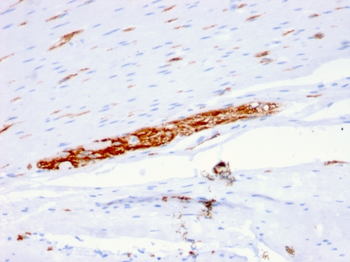 NCAM1 Antibody
