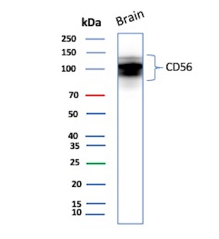 NCAM1 Antibody