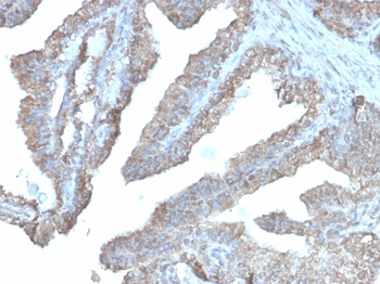 ODC1 Antibody