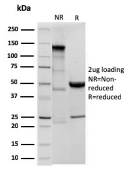 ODC1 Antibody