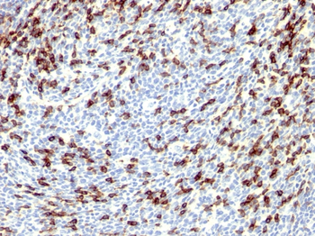 PDCD1 Antibody
