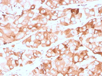 PRLR Antibody