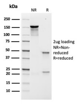 PRLR Antibody