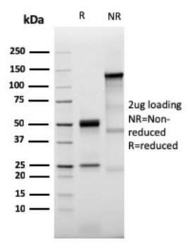 PRLR Antibody
