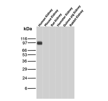 PRLR Antibody