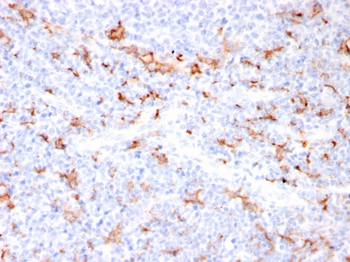S100A8 Antibody