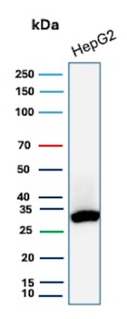 SDHB Antibody