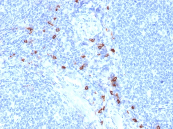 TPSAB1 Antibody