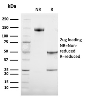 TYRP1 Antibody