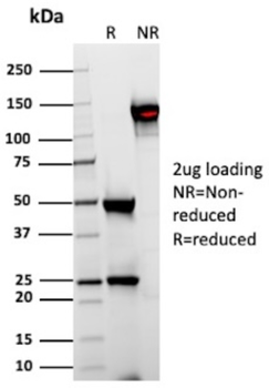 TYRP1 Antibody