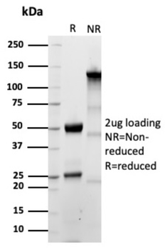 CALD1 Antibody
