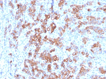 HAVCR2 Antibody