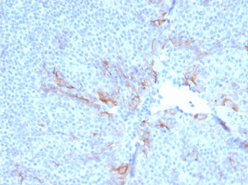 HAVCR2 Antibody