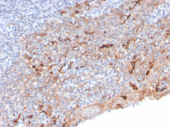 HAVCR2 Antibody