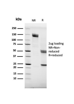 MS4A1 Antibody