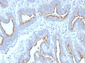 ATG5 Antibody