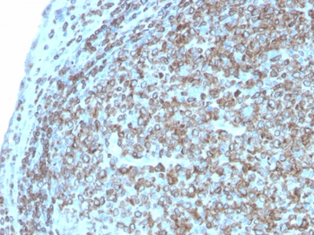 CD74 Antibody