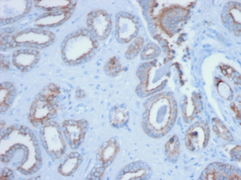 Cytokeratin, pan (Epithelial Marker) Antibody
