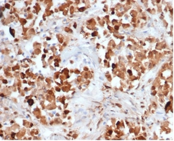 GH1 Antibody