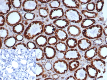 HSPD1 Antibody
