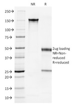 KRT7 Antibody (Biotin)