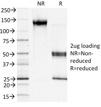 S100A4 / Metastasin / Calvasculin (Marker of Tumor Metastasis) Antibody