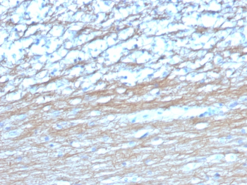 UCHL1 Antibody