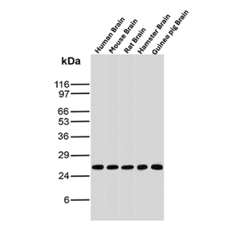 UCHL1 Antibody