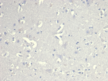 CD38 Antibody