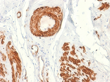 CALD1 Antibody