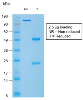 CALD1 Antibody