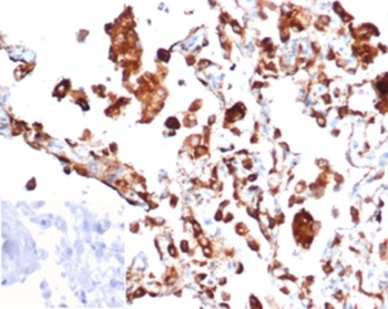 NAPSA Antibody