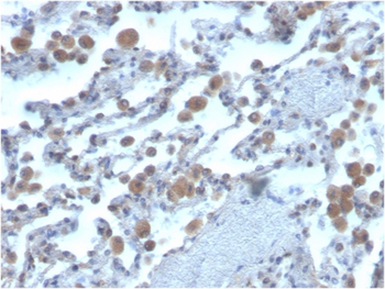 RAC1 Antibody