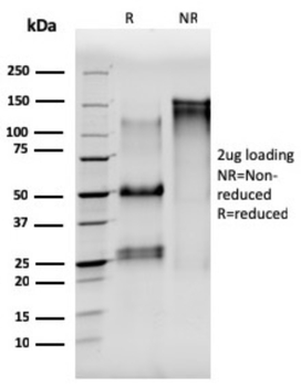TUBA1B Antibody
