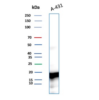 FTL Antibody