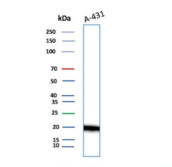 FTL Antibody