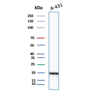 FTL Antibody