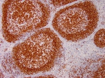 PAX5 Antibody (Biotin)