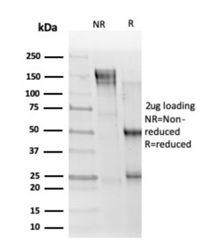 ELK1 Antibody