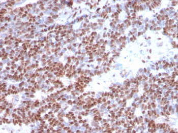 ESR1 Antibody (Biotin)