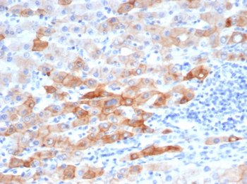 KRT8 Antibody