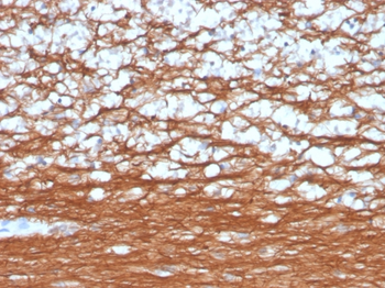 UCHL1 Antibody