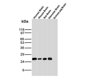UCHL1 Antibody