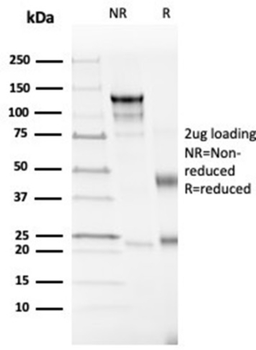 CD4 Antibody
