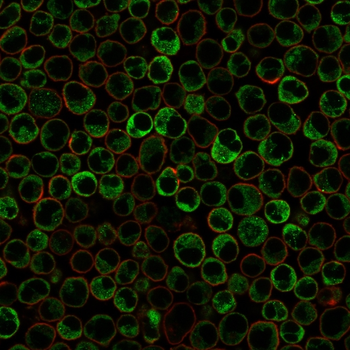 Recombinant Double Stranded DNA (dsDNA) (Nuclear Marker) Antibody