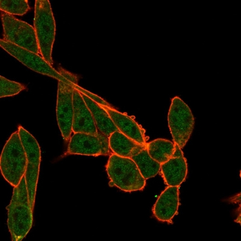 SMNDC1 Antibody